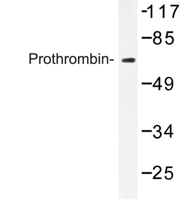 Polyclonal Rabbit anti-Human F2 / Prothrombin / Thrombin Antibody (Gly724, IHC, IF, WB)