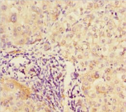 Polyclonal Rabbit anti-Human DPF1 / Neuro-D4 Antibody (IHC)