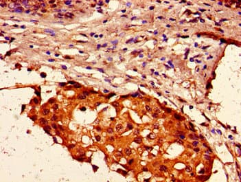 HIST1H2AI Antibody