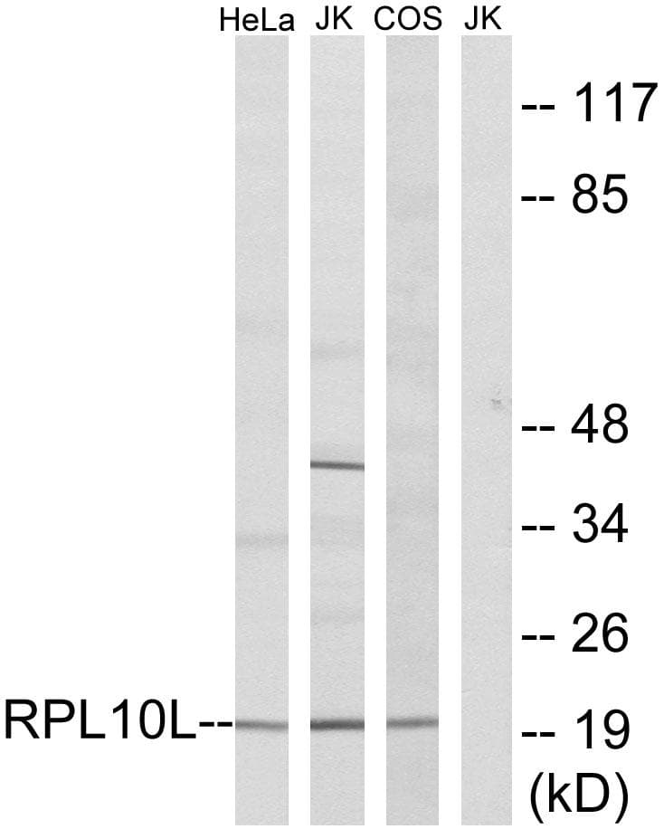 RPL10L Antibody