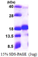 Human UBE2W Protein (Recombinant His)