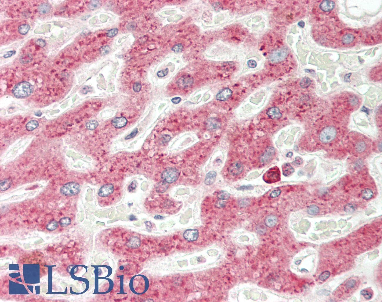PathPlus™ Polyclonal Goat anti-Human VEGFA / VEGF Antibody (aa250-300, IHC, WB)