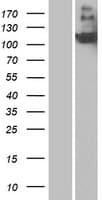 CR2 / CD21 Protein (Over-Expression Lysate Myc-DDK (Flag))