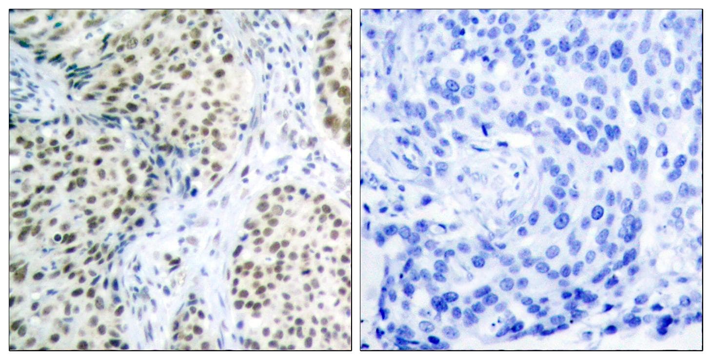 Polyclonal Rabbit anti-Human ATM Antibody (p1981, IHC)