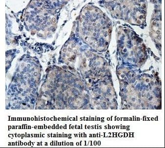 Polyclonal Rabbit anti-Human L2HGDH Antibody (aa65-216, IHC, WB)