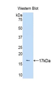 NPEPPS Antibody (aa141-272)