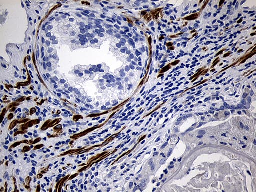 Monoclonal Mouse anti-Human C1orf111 Antibody (clone OTI2A9, IHC, WB)