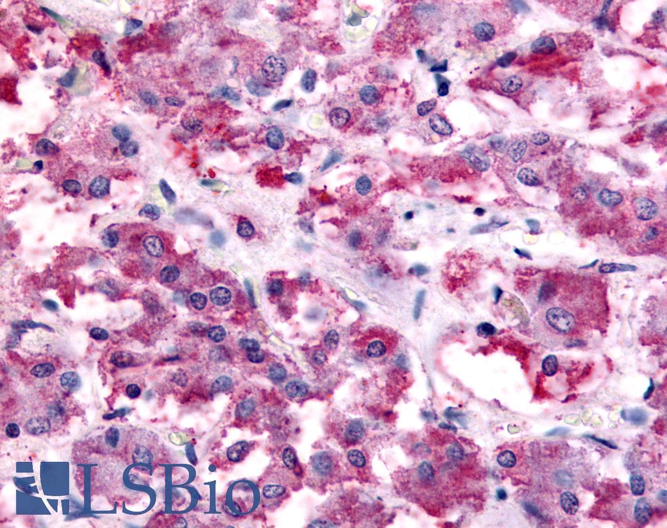 IHC-plus™ Polyclonal Rabbit anti-Human NMUR2 Antibody (N-Terminus, IHC)