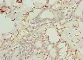 Polyclonal Rabbit anti-Human TMEM154 Antibody (IHC, WB)