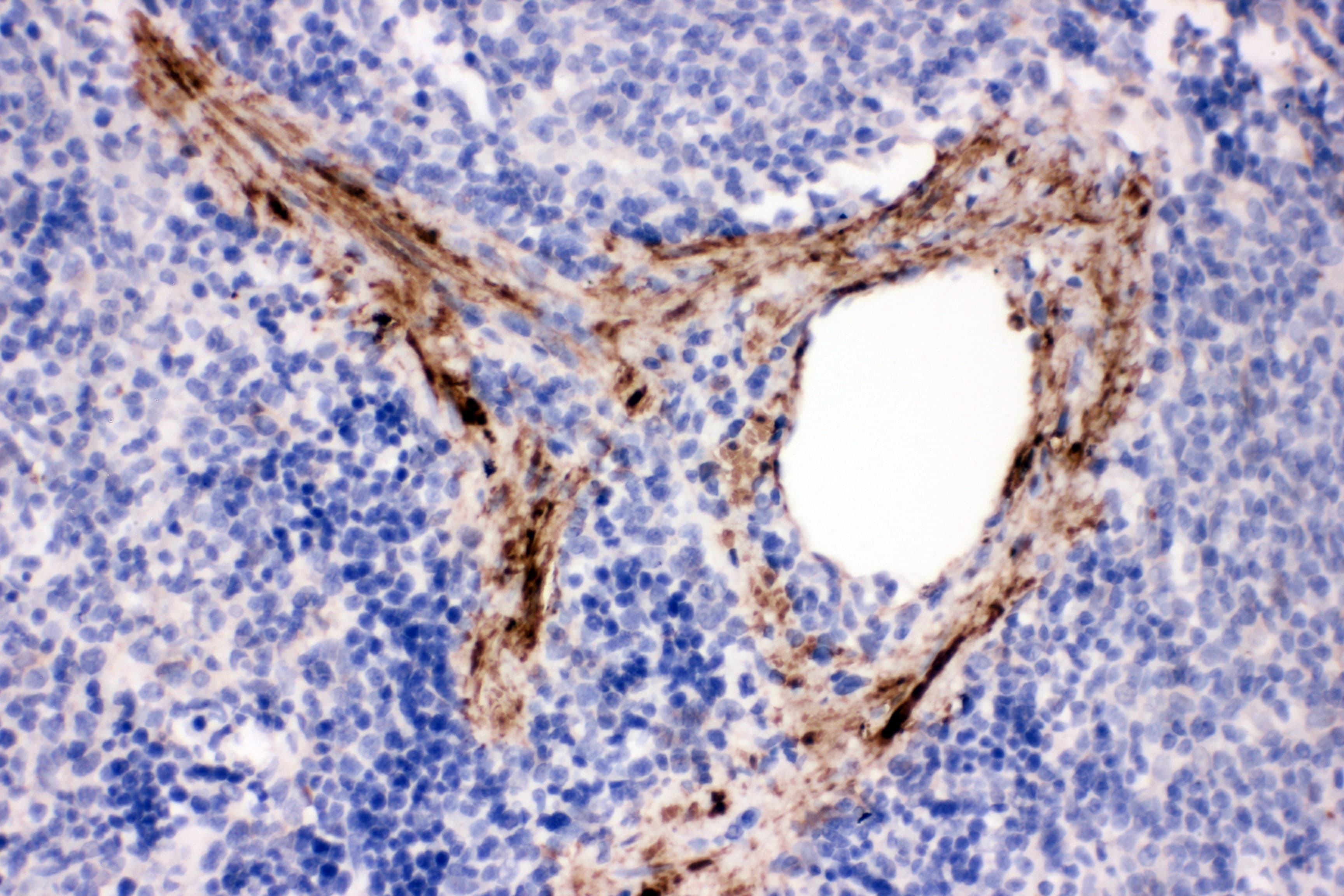 ADAM19 Antibody (aa286-298)