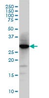 HMT / HNMT Antibody (clone 3G12)