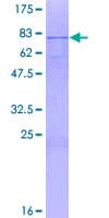 Human MICU1 / CBARA1 Protein (Recombinant GST)