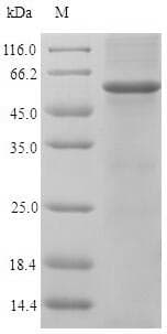 Chicken EN1 / Engrailed Protein (Recombinant 6His-B2M, N-terminus)