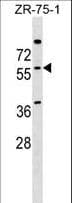 Polyclonal Rabbit anti-Human NOVA2 Antibody (aa87-114, WB)
