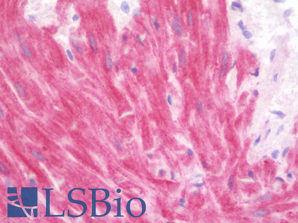 IHC-plus™ ABHD6 Antibody (aa231-280)