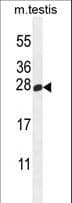 Polyclonal Rabbit anti-Human PLD6 / Phospholipase D6 Antibody (aa125-154, WB)