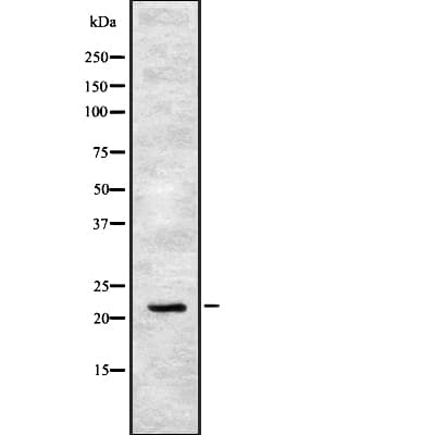 IFNA17 / Interferon Alpha 17 Antibody