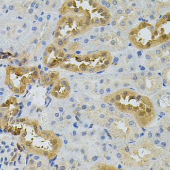 Polyclonal Rabbit anti-Human TSC501 / NAT8 Antibody (IHC, WB)
