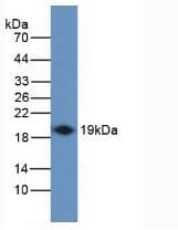 IFN Gamma / Interferon Gamma Antibody (aa24-166, PE)