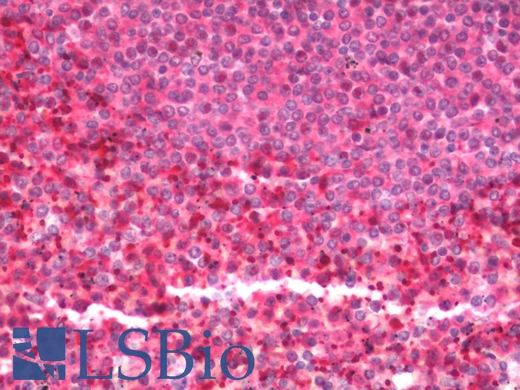 IHC-plus™ VCL / Vinculin Antibody