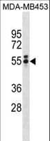 TBXT / T / Brachyury Antibody (aa15-43)