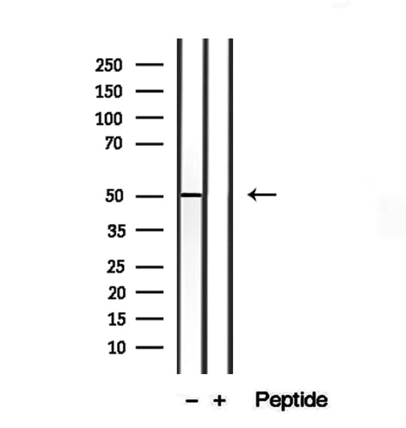 Cardiolipin Synthase / CRLS1 Antibody