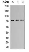 Eosinophil Peroxidase / EPX Antibody (Internal)