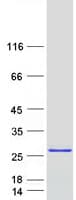 Human PRR15 Protein (Recombinant Myc-DDK (Flag))