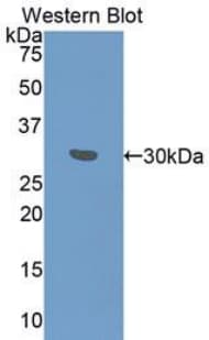 FGG / Fibrinogen Gamma Antibody (aa166-416)