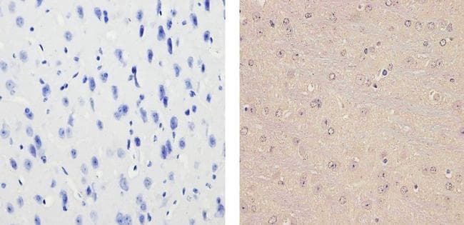 Monoclonal Mouse anti-Human NR3C1/Glucocorticoid Receptor Antibody (clone 6000000, IHC, IF, WB)