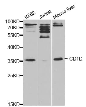 IHC-plus™ Polyclonal Rabbit anti-Human CD1D Antibody (IHC, IF, WB)