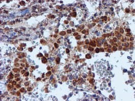 NDUFB9 Antibody (clone OTI13H11)