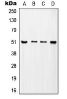 TADA2L / ADA2A Antibody (Internal)