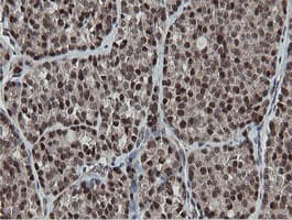 MIPEP Antibody (aa174-516, clone OTI3F8, Carrier-free)