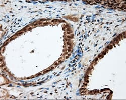 Monoclonal Mouse anti-Human LIPG / Endothelial Lipase Antibody (clone OTI3G7, IHC, WB)