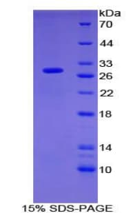 Human OIT3 Protein (Recombinant His-T7)
