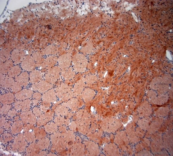 Polyclonal Rabbit anti-Human NeuN Antibody (aa80-130, IHC, WB)