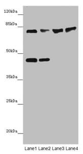 Polyclonal Rabbit anti-Human ZNF169 Antibody (IHC, WB)