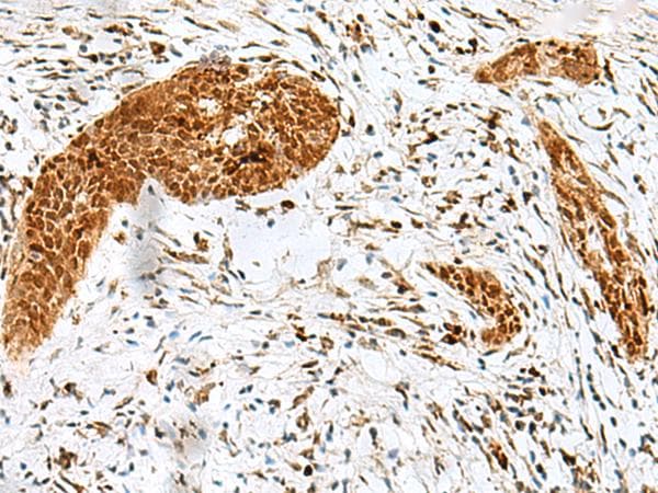 Polyclonal Rabbit anti-Human HMG20A Antibody (IHC)