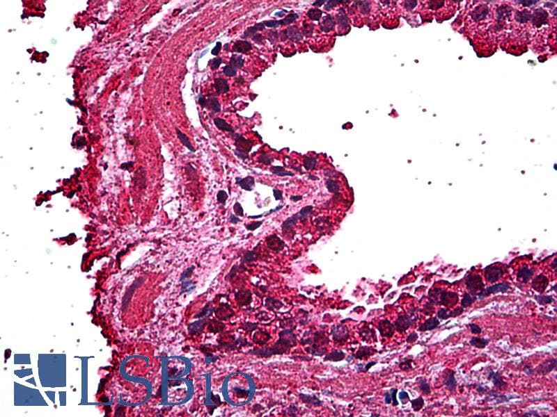 IHC-plus™ Monoclonal Mouse anti-Human ERN1 / IRE1 Antibody (clone 3D1, IHC, WB)
