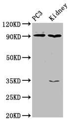 CDK11A / CDC2L2 Antibody
