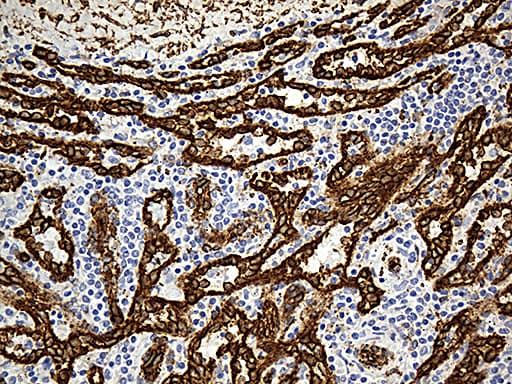 Monoclonal Mouse anti-Human CAV1 / Caveolin 1 Antibody (clone OTI2C4, Carrier-free, aa2-104, IHC, WB)