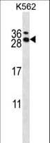 RCAN3 / Calcipressin 3 Antibody (aa194-222)