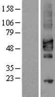 CRLF2 / TSLPR Protein (Over-Expression Lysate Myc-DDK (Flag))