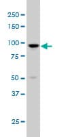 ARHGAP6 Antibody (clone 6B3)