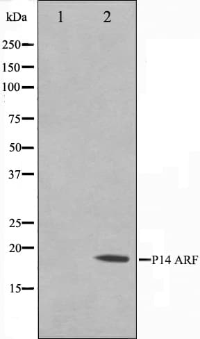 Polyclonal Rabbit anti-Human p14ARF / CDKN2A Antibody (IHC, IF, WB)