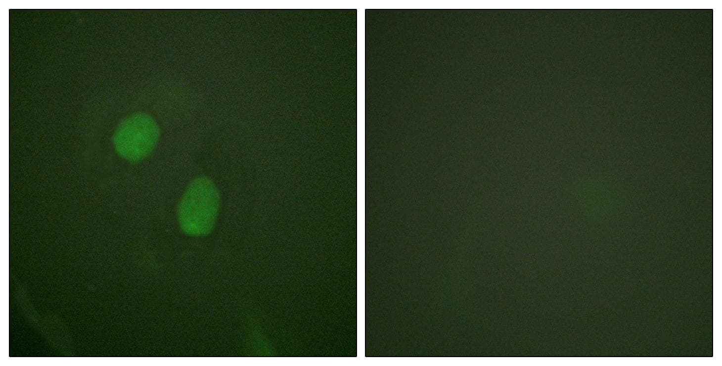 ER Alpha / Estrogen Receptor Antibody (phospho-Ser305)