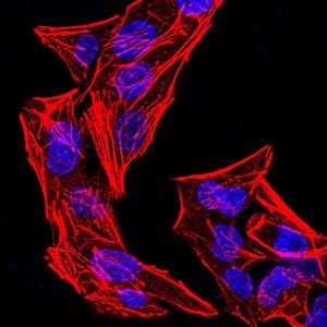 IPAF / NLRC4 Antibody (aa525-538, phospho-Ser533, clone 9A6A1)