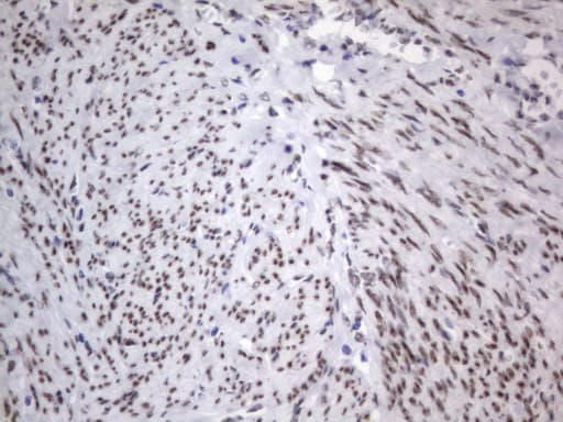 RBFOX1 / A2BP1 Antibody (aa1-210, clone OTI4F9)