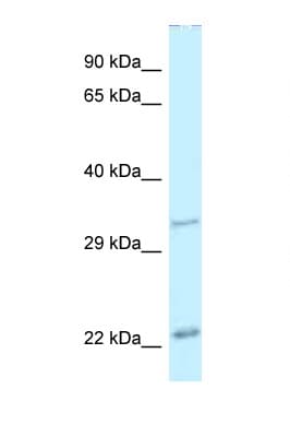 Polyclonal Rabbit anti-Mouse PDX1 Antibody (aa36-85, IHC, WB)